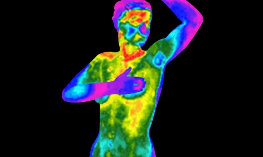 Total Wellness Thermography